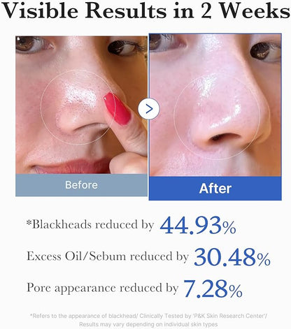 Medicube Zero Pore Pad 70 Pads