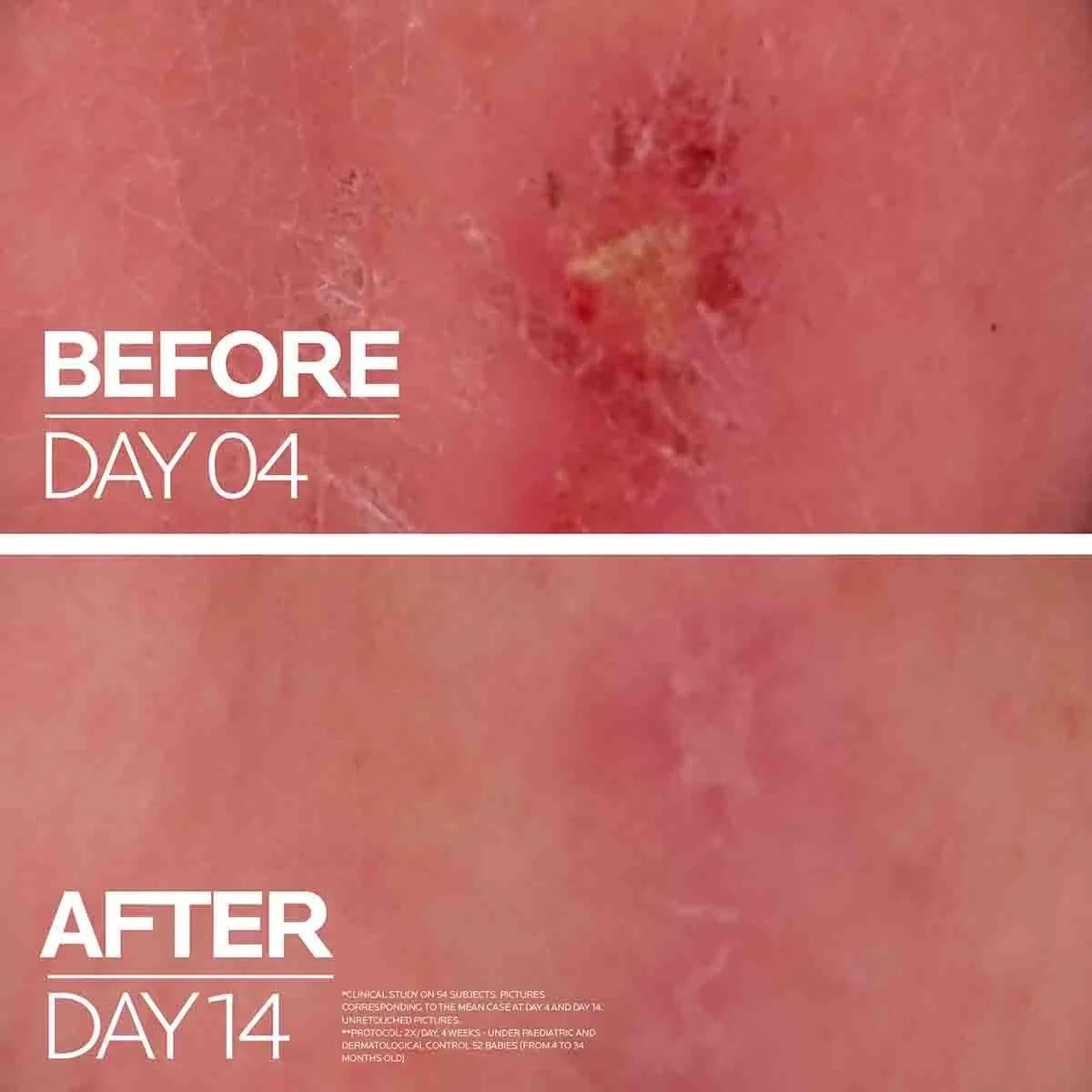 La Roche-Posay Cicaplast Baume B5+ Repair Balm
