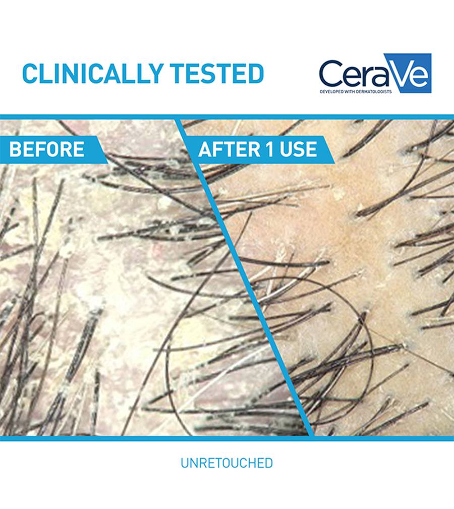 CeraVe Anti-Dandruff Hydrating Shampoo
