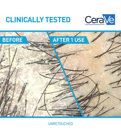 CeraVe Anti-Dandruff Hydrating Shampoo